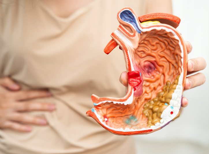Stomach disease, Asian woman holding anatomy model for treatment in hospital.